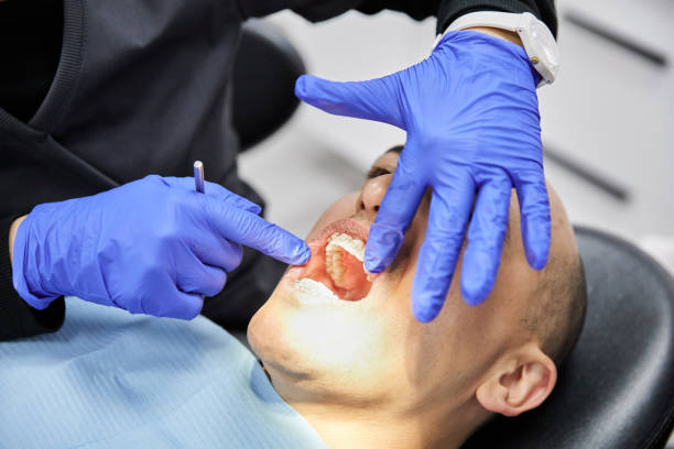 Best Tooth Infection Emergency Dentist  in Squirrel Mountain Valley, CA