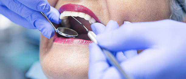 Best Teeth Whitening  in Squirrel Mountain Valley, CA